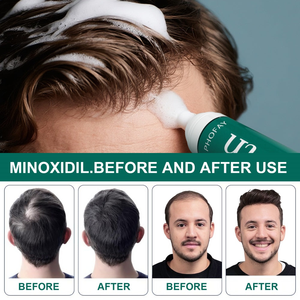 Minoxidil Hair Growth Mousse – Anti Hair Loss Foam